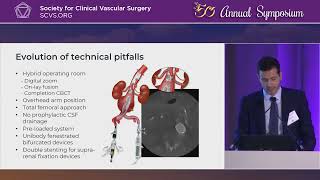 Scientific Session I Aortic [upl. by Orthman]