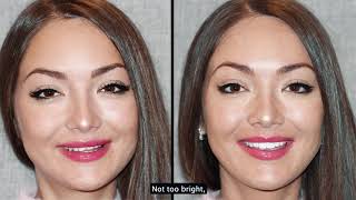 Composite Bonding Smile Makeover with Dr Emanuel Layliev  New York Center for Cosmetic Dentistry [upl. by Auahsoj]