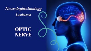 NEUROOPHTALMOLOGY lecture 7 PAPPILOEDEMA complete explanation [upl. by Pavlov]