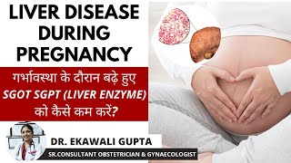 Pregnancy amp Liver Disease  बढ़े हुए SGOT SGPT LIVER ENZYME को कैसे कम करें  Healing Hospital [upl. by Collete408]