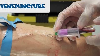 Venipuncture  How to take Blood  OSCE Guide old version  UKMLA  CPSA [upl. by Nessej715]