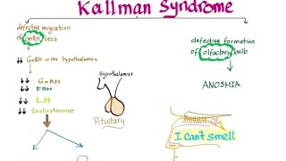 kallmannsyndromegnrhhypothalmusfshlh [upl. by Akeihsal]