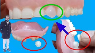 How to repair a broken denture tooth  How to fix a broken denture tooth at homeTooth repair [upl. by Lynd304]