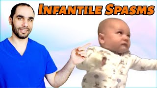 Infantile Spasms Causes And Treatment [upl. by Tenn70]