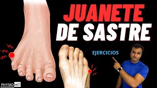 JUANETE DE SASTRE EJERCICIOS FISIOTERAPIA Y REHABILITACIÓN [upl. by Kumar442]