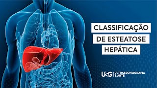 Cardiologista responde 5 Sinais de Esteatose Hepática Sintomas de Gordura no Fígado [upl. by Imoin]