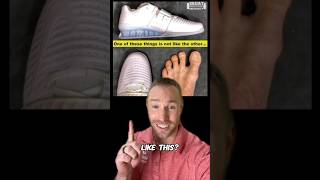 You NEED Toe Spacers amp Barefoot Shoes [upl. by Keifer523]