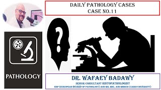 DIALY PATHOLOGY CASES CASE NO 11 Dr Wafaey Badawy [upl. by Nivan]