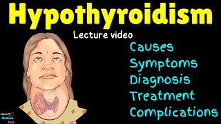 Hypothyroidism Underactive Thyroid Causes Symptoms Diagnosis Treatment Complications [upl. by Mott]