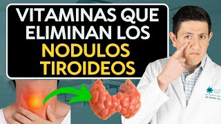 Como eliminar Nódulos en la Tiroides Dr Antonio Cota Sugar Care [upl. by Maressa]