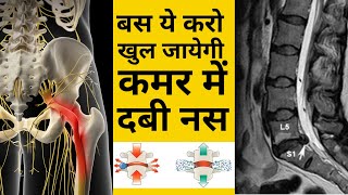 बस ये करो ठीक हो जाएगी कमर में दबी नस  L4L5 disc Bulge  SCIATICA  DABI NAS  leg pain  Hip pain [upl. by Noreik]