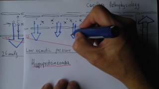 Capillaries 6 Hypoproteinemia [upl. by Annola]