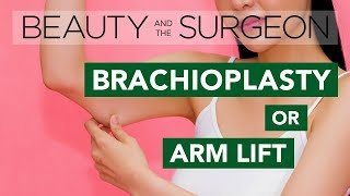 Arm Lift or Brachioplasty  Beauty and the Surgeon Episode 47 [upl. by Anilrats475]