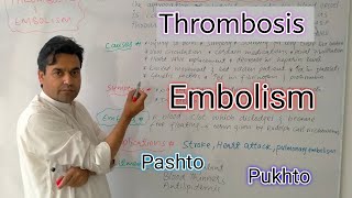 Thrombosis and Embolism  Biology class 11  Dr Mushtaq Pashto Lectures [upl. by Fougere]