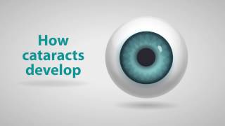 What Are Cataracts  A Closer Look At Cataracts [upl. by Howard]