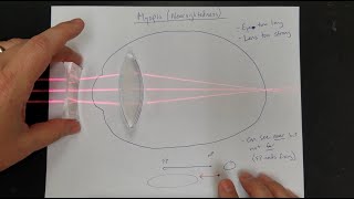 Vision Correction Normal Eyes Myopia Hyperopia Near amp Far Point Lens Power [upl. by Rusert]