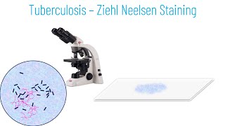 Ziehl Neelsen Staining Principle and Procedure [upl. by Patt]