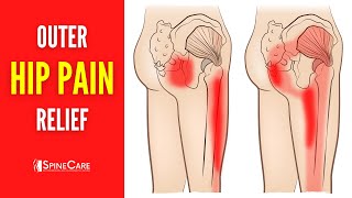 How to Fix Outer Hip Pain FOR GOOD [upl. by Assenat]