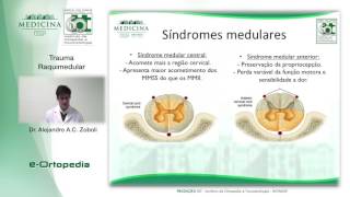 Trauma Raquimedular  Dr Alejandro A C Zoboli [upl. by Ellecrag617]