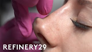 I Tried A NonSurgical Nose Job  Macro Beauty  Refinery29 [upl. by Yllet]