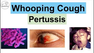 Whooping Cough Pertussis  Transmission Pathophysiology Symptoms Diagnosis Treatment [upl. by Dillon]