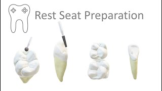 RPD Rest Seat Preparation technique in 6 mins [upl. by Yatnuhs]