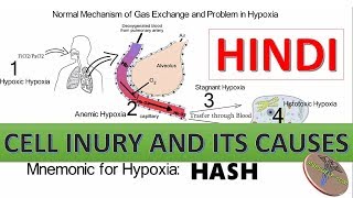 Cell Injury Hypoxia and Causes with Mnemonic in Hindi [upl. by Ransell808]