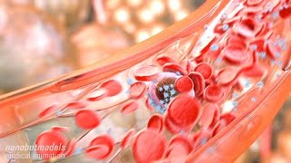 Metastasis and angiogenesis [upl. by Ettennek]