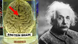 How Einsteins Brain was Different [upl. by Hgiellek300]