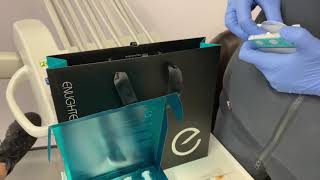 Enlighten Teeth Whitening patient demo [upl. by Macintyre]