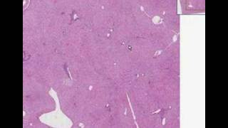 Histopathology LiverNormal [upl. by Cupo15]