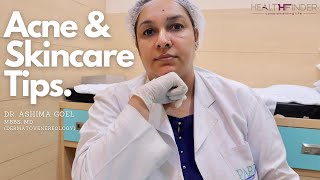 Acne Skin Care Tips by Dr Ashima Goel  Best Dermatologist In Chandigarh  HealthFinder [upl. by Drof]