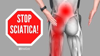 How to Relieve Sciatica Pain in SECONDS [upl. by Love740]