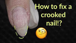 How to Fix Crooked Nail  Gel Overlay Fill [upl. by Lletram]