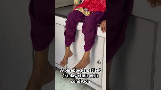 paraplegia patient paralysistreatment paralysis physiotherapytreatment shortsvideo shortsfeed [upl. by Follmer]