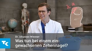 Was tun bei einem eingewachsenen Zehennagel  Dr Johannes Wimmer [upl. by Silado835]