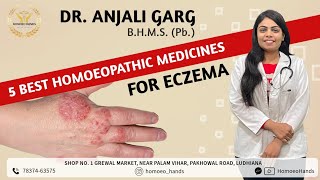 Best homeopathic medicines for Eczemaएक्जिमा का जड़ से इलाजDERMATITISDR ANJALI GARGHOMOEO HANDS [upl. by Ignace]