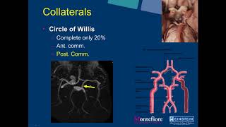 SIRRFS Webinar 2272018 Neuro Interventional Radiology Carotid Artery Stenting [upl. by Egor]