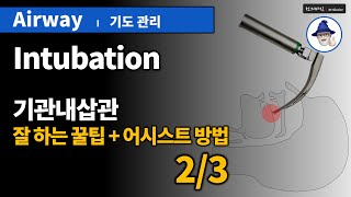 A22 기도관리 5 기관내삽관 잘하는꿀팁어시스트 23  Airway management Intubation [upl. by Tuttle]