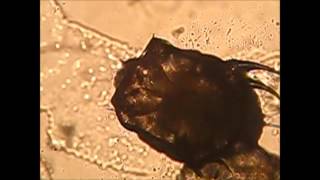 moving scabies mite 2 [upl. by Lauralee]