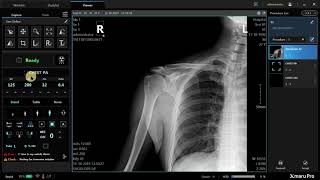 Introduction to Rayence Xmaru Pro Xray Console [upl. by Karmen172]