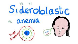 Sideroblastic Anemia [upl. by Nomaid]