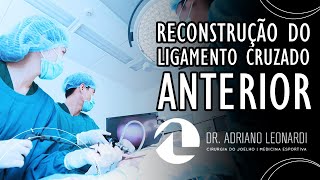 RECONSTRUÇÃO DO LIGAMENTO CRUZADO ANTERIOR  Dr Adriano Leonardi [upl. by Ailima]