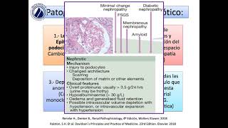 Síndromes glomerulares [upl. by Sheri]