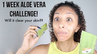 1 WEEK ALOE VERA CHALLENGE REAL RESULTS Will it clear acne and fade scars  BiancaReneeToday [upl. by Negah]