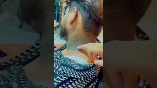 Remove dark spots pigmentationfrom neck  Dark neck remove remedy ytshorts [upl. by New267]