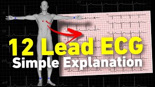 12 lead ECG  ECG interpretation made easy • Daily Cardiology [upl. by Carolyne]