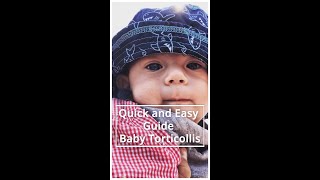 5 Signs Your Baby May Have Torticollis Quick And Easy Guide [upl. by Barbette]