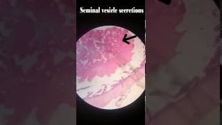 Seminal Vesicle Histology [upl. by Yla]