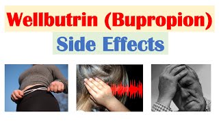 Wellbutrin Bupropion Side Effects To Watch Out For amp Why They Occur [upl. by Ottie189]